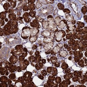 Anti-NOSTRIN antibody produced in rabbit 