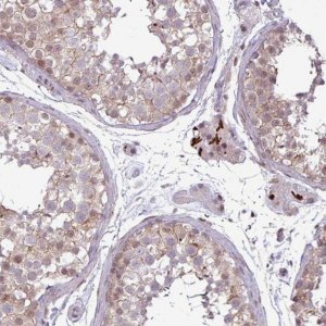 Anti-NOTCH2 antibody produced in rabbit 