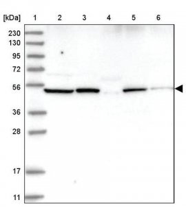 Anti-NOX1 antibody produced in rabbit HPA035299-100UL