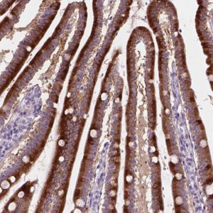 Anti-NOXO1 antibody produced in rabbit 