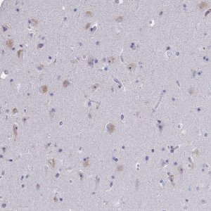 Anti-NOXRED1 antibody produced in rabbit 