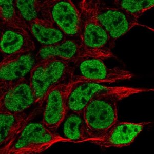 Anti-NPAS1 antibody produced in rabbit 