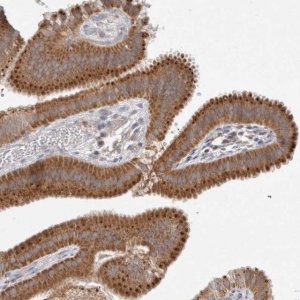 Anti-NPC1 antibody produced in rabbit 