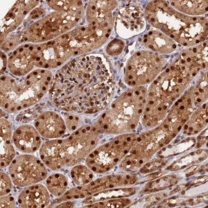 Anti-NPEPL1 antibody produced in rabbit HPA036356-100UL
