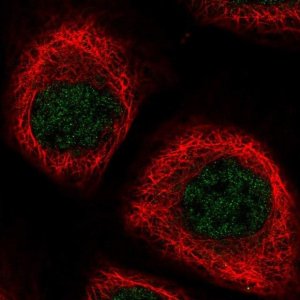 Anti-NPEPL1 antibody produced in rabbit HPA036356-100UL