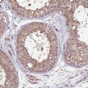 Anti-NPHP1 antibody produced in rabbit 