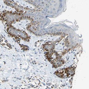 Anti-NPHP3 antibody produced in rabbit 