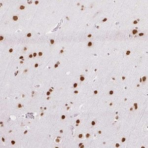 Anti-NPIPA1 antibody produced in rabbit 