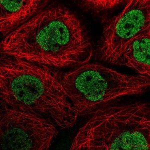 Anti-NPIPA1 antibody produced in rabbit 