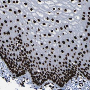 Anti-NPM1 antibody produced in rabbit 