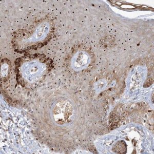 Anti-NPM3 antibody produced in rabbit 