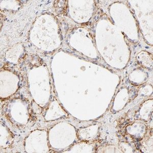 Anti-NPNT antibody produced in rabbit 