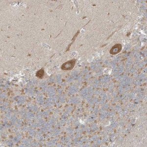 Anti-NPPC antibody produced in rabbit 