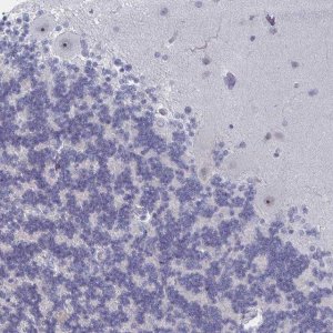 Anti-NR1H2 antibody produced in rabbit 