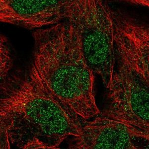 Anti-NR2F2 antibody produced in rabbit 