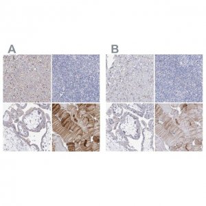 Anti-NRAP antibody produced in rabbit 