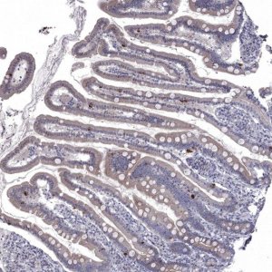 Anti-NRARP antibody produced in rabbit 