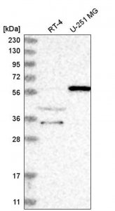 Anti-NRBP2 antibody produced in rabbit 