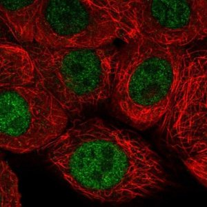 Anti-NRDE2 antibody produced in rabbit 