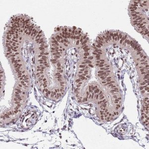 Anti-NRIP1 antibody produced in rabbit 