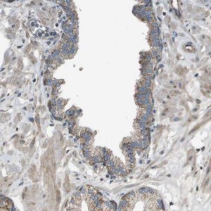 Anti-NRK antibody produced in rabbit 