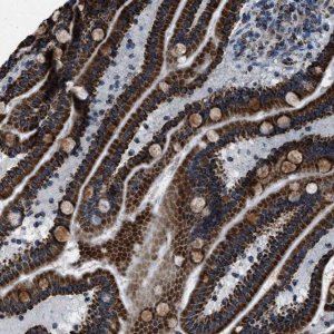 Anti-NSD3 antibody produced in rabbit 