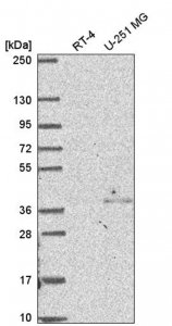 Anti-NSL1 antibody produced in rabbit 