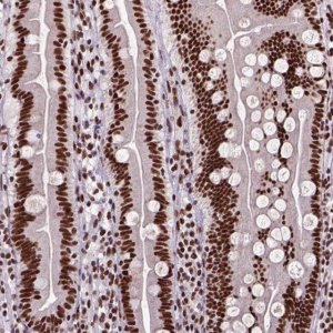 Anti-NSMCE2 antibody produced in rabbit 