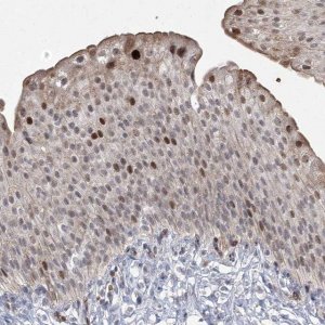 Anti-NSMCE4A antibody produced in rabbit 