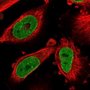 Anti-NSUN3 antibody produced in rabbit 