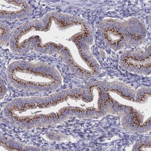 Anti-NSUN6 antibody produced in rabbit 