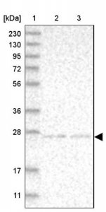 Anti-NT5C antibody produced in rabbit HPA021581-100UL
