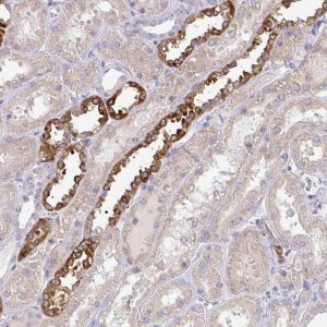Anti-NT5C1A antibody produced in rabbit 