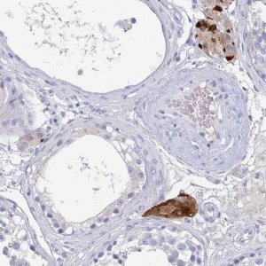 Anti-NT5C3B antibody produced in rabbit 