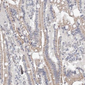 Anti-NT5DC1 antibody produced in rabbit HPA030352-100UL