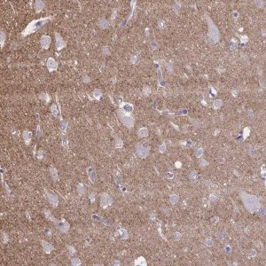 Anti-NTN1 antibody produced in rabbit 