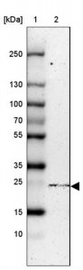 Anti-NTPCR antibody produced in rabbit HPA028125-100UL