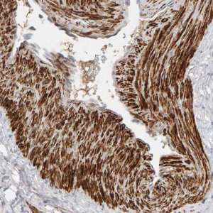 Anti-NUDCD1 antibody produced in rabbit 