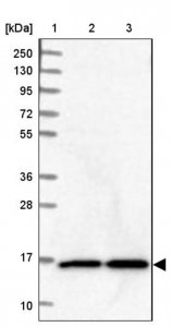Anti-NUDCD2 antibody produced in rabbit HPA037384-100UL
