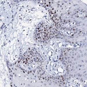 Anti-NUDT13 antibody produced in rabbit 