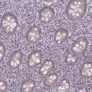 Anti-NUDT16 antibody produced in rabbit 