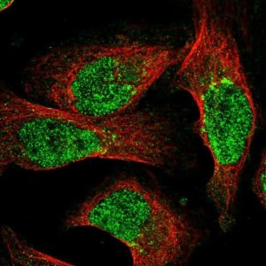 Anti-NUDT18 antibody produced in rabbit 