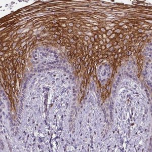 Anti-NUDT3 antibody produced in rabbit 
