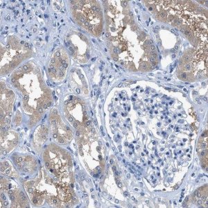 Anti-NUDT5 antibody produced in rabbit 