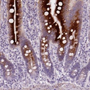 Anti-NUDT6 antibody produced in rabbit 