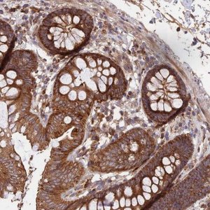 Anti-NUDT8 antibody produced in rabbit 