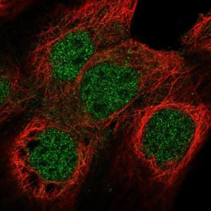 Anti-NUF2 antibody produced in rabbit 