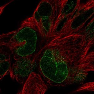 Anti-NUP133 antibody produced in rabbit HPA059767-100UL
