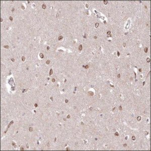Anti-NUP155 antibody produced in rabbit HPA037774-100UL