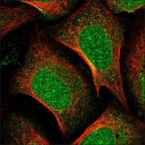 Anti-NUP155 antibody produced in rabbit HPA037774-100UL
